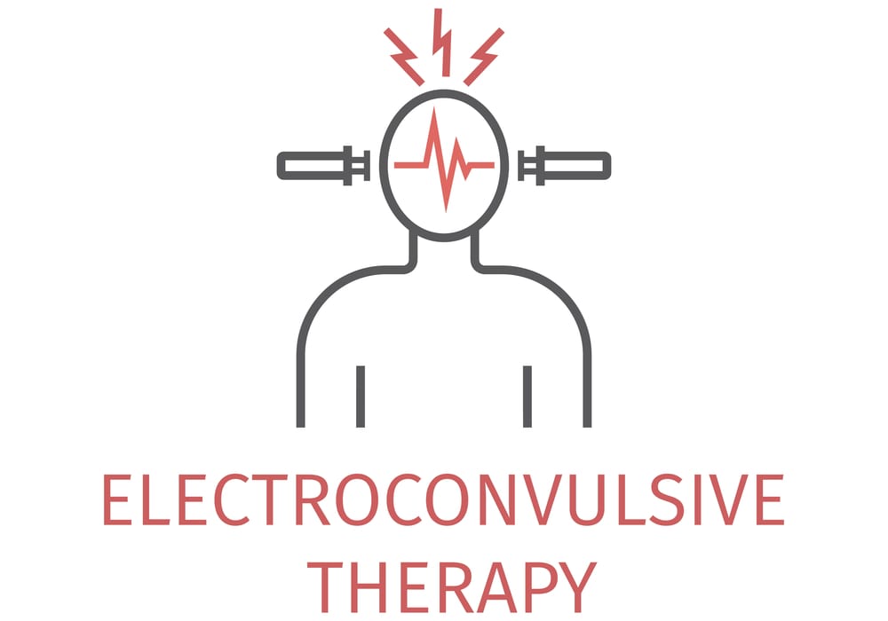 Concerns with Electroconvulsive therapy for Depression