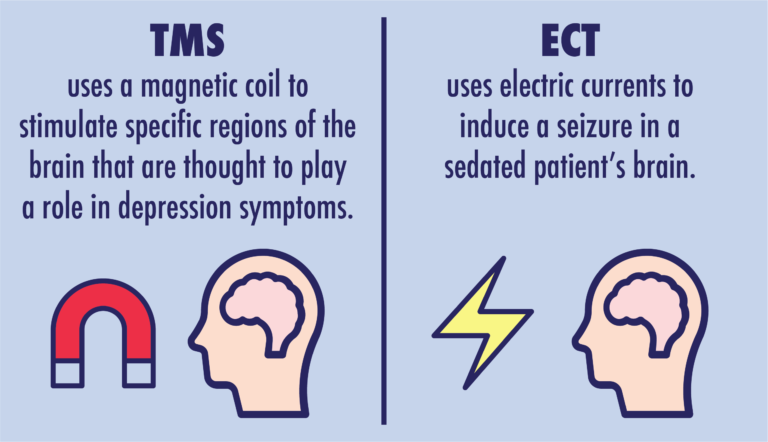 Los Angeles TMS Therapy And Depression Treatment | TMS VS ECT: What’s ...